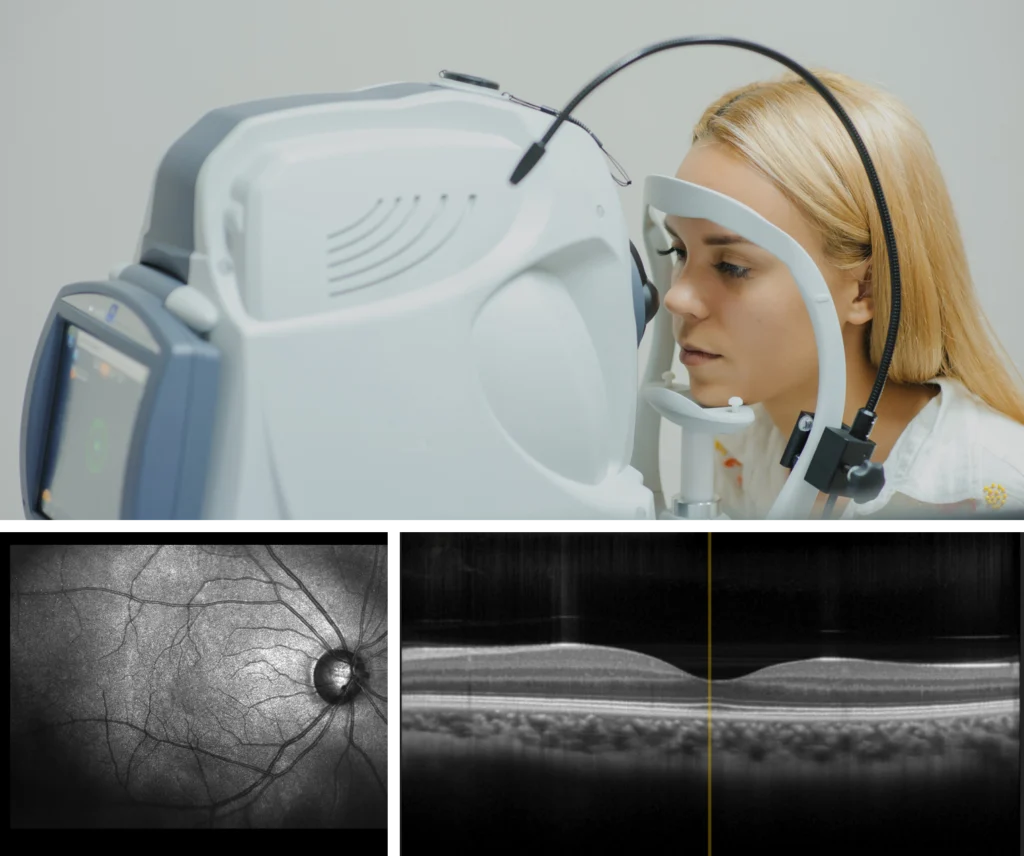 Optical Coherence Tomography (OCT) Scan